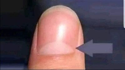هل تساءلت يوماً على ماذا يدل وجود القوس الابيض الموجود على ظفرك ؟