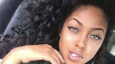 When she was 3 years old, she was referred to as “the most beautiful girl in the world.” At the age of 17, she looks like this